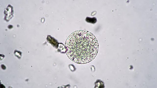 Round multicellular protozoan animal under a microscope. Round cover of the egg is protecting it's inhabitant from the danger. Theme of laboratory biological research under microscope.