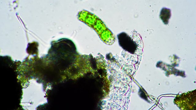 Large green water bear runs very fast in water under a microscope. Theme of laboratory biological research tardigrade under microscope. Microscopic animal in a drop of water under magnification.