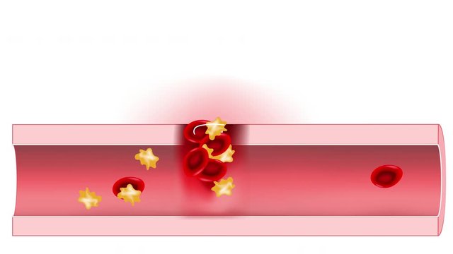 Hemostasis. Red blood cells and platelets in the blood vessel. Basic steps of wound healing process. 2D animation.