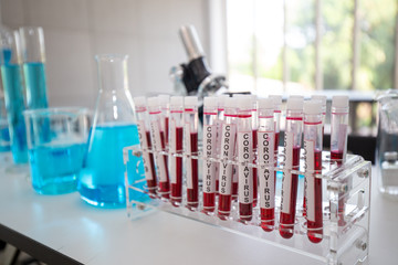 Focus on one blood sample in the tube. 
Close-Up on Covid 19 blood tube for Vaccine research in Laboratory on background of Scientific Lab.
