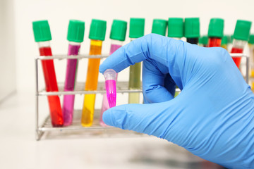 Micro Centrifuge tube with pink solvent or solution handle in hands wear nitrile blue gloves, with colorful culture cell tubes cover with green cap, biotechnology analysis experiment for anti-virus.