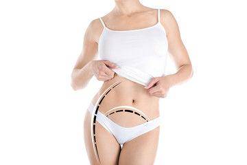 Correction, skin lifting and abdominoplasty. Female beautiful faceless body with marking lines on the hips and belly, isolated on white.