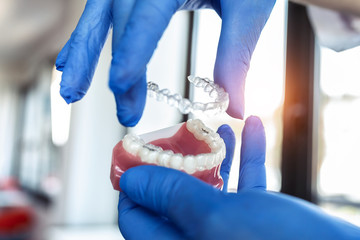 The doctor’s hands in blue gloves hold an artificial model of the jaw with invisible braces. The...