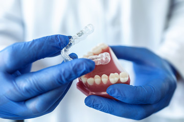 The doctor’s hands in blue gloves hold an artificial model of the jaw with invisible braces. The...