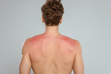 Back view of man with sunburn isolated on grey