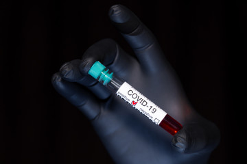 Test tube with a blood test in the hands of a doctor. Positive result for coronavirus COVID-19. The doctor's hand is in a black glove.