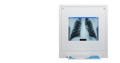 xray