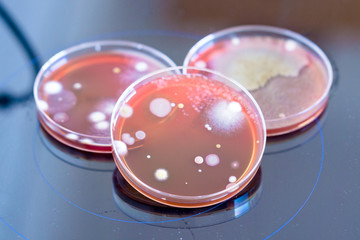 petri dishes with colonies of microorganisms in a biological laboratory