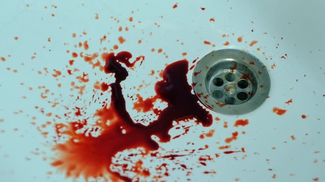 A lot of blood in the washbasin.