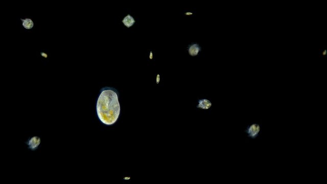 Plankton under a microscope, video: ciliates Bursaria, Halteria sp., Algae Cryptophyta. move randomly on a black background