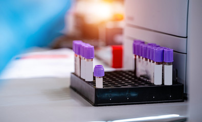 Test tubes with blood on a tray. Blood laboratory. Illness testing. Emergency testing. Virus...