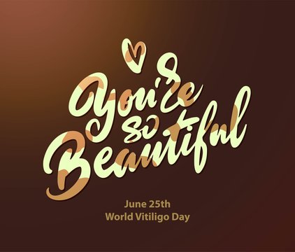 The inscription you are so beautiful, lettering to the world vitiligo day.