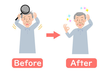 頭皮のフケに悩むおじいちゃんのビフォーアフターベクターイラスト