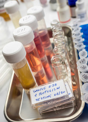 Samples contaminated by Clostridium botulinum toxin that causes botulism in humans, laboratory research, conceptual image