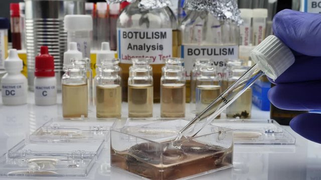 Experienced laboratory scientist analyzing a sample from a canned food can, botulism infection in sick people