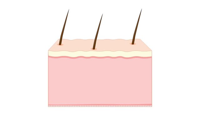 Skin changes after beauty injection. botulinum toxin injections. cosmetic filler. 