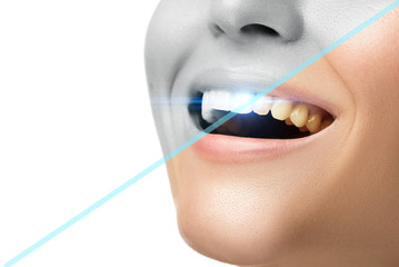 Teeth whitening and hygiene