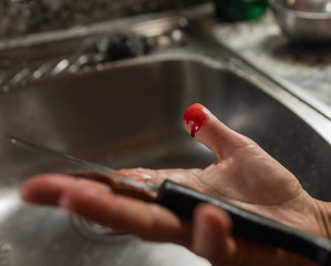 Finger cuts with blood with a knife while cooking. Stock image of a cooking accident resulted in a cut on the thumb with blood.