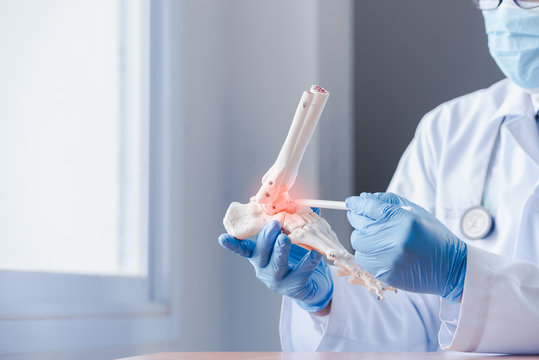 Orthopedic Doctor Looking At Fake Ankle Bone Wear A Medical Mask And Wear Gloves To Diagnose The Cause Of Ankle Degeneration In The Hospital Office.