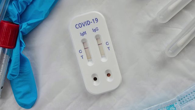 antibody immunological serological quick covid covid-19 test negative dolly
