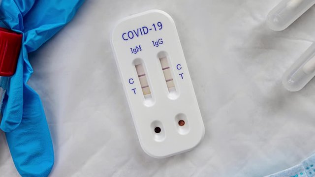 antibody immunological serological quick covid-19 test dolly positive