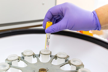 Covid-19. A worker in medical gloves puts a sample in a laboratory centrifuge, close-up. Concept of scientific and medical research of the coronavirus vaccine