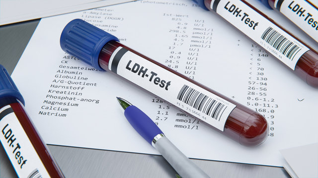 LDH Test durch Blutprobe