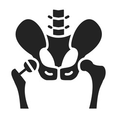 Arthroplasty glyph black icon. Hip replacement implant installed in the pelvis bone. Isolated vector element.  - obrazy, fototapety, plakaty