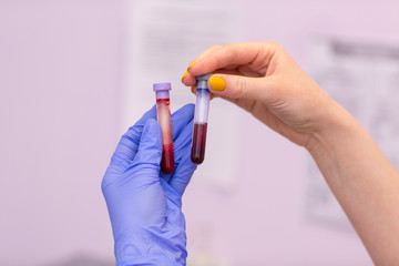 Laboratory assistant in medical laboratory holds test tube with blood and plasma in his hand and...