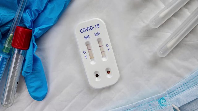 antibody immunological serological quick covid-19 test igg positive 