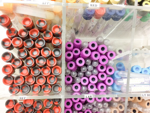 Blood test sample vials at medical laboratory close up