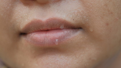 
Sweating on the lips and face of women.