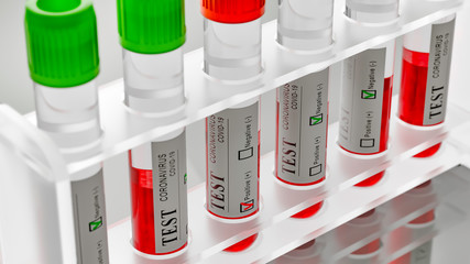 Blood test tubes with positive and negative covid-19 ( coronavirus ) results. Photorealistic 3d render.