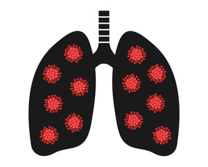 Pneumonia and lung cancer - disease and illness is damaging internal organ in human body. Health problem based on infection, virus, bacteria, tumor and carcinoma. Vector illustration.