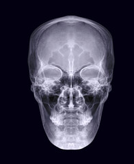  Skull x-ray image of Human skull  AP or front view  isolated on Black Background. clipping path.