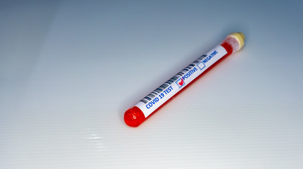 Test tube with blood inside and marker of a covid 19 positive result. Blood sample of a covid 19 patient inside a test tube with a positive result.