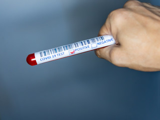 Hand holding a test tube with blood for covid 19 testing. Test tube used for corona virus testing. Covid 19 positive result