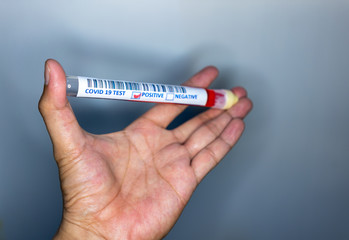 Hand holding a test tube with blood for covid 19 testing. Test tube used for corona virus testing. Covid 19 positive result
