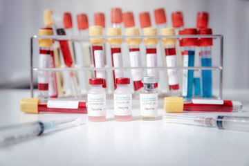 Sample of coronavirus vaccine (COVID-19) on work table in a medical lab.