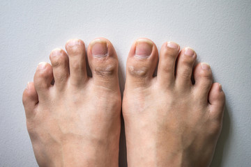 The foot and long nail toes on white concrete background. Long nails and dirty may cause fungal.