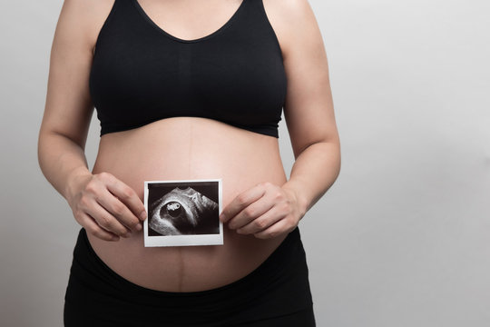 Close up Asian pregnant woman with black bra holding the ultrasound picture of her baby in her stomach, studio light portrait and copy space on grey background