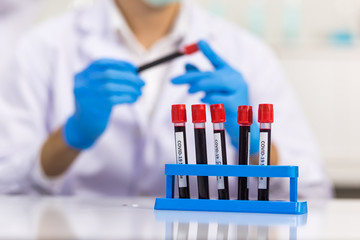 Rack of blood tubes with a label for virus identification is placed in front of a microbiologist who is working in the laboratory.