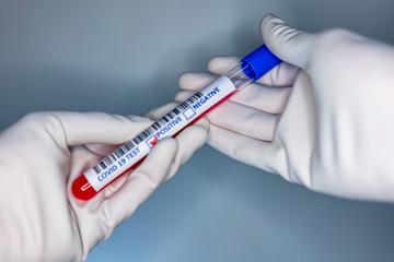 Obraz premium Blurry image of a nurse hands while holding a test tube containing a patient’s sample that has tested positive for coronavirus