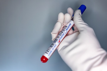 Naklejka premium Blurry image of a nurse hands while holding a test tube containing a patient’s sample that has tested positive for coronavirus