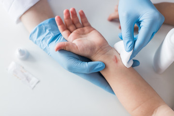 doctor treats a wound to a child, disinfection of a cut on a person, first aid to a child. Top view.