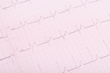 light heartbeat cardiogram background, close-up