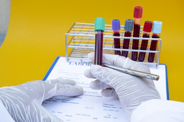 Professional doctors perform COVID-19 tests from samples of blood tests to diagnose coronary virus...
