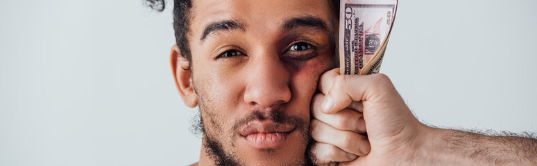 Male hand holding dollar banknotes near face of african american man with bruise isolated on grey,...
