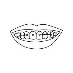 Smiling lips with teeth and braces. Black outline on white background. Vector illustration can be used in greeting cards, posters, flyers, banners, promotions, invitations etc. EPS10