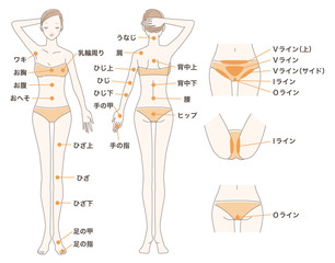 女性 脱毛 全身